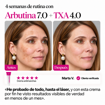 Crema Antimanchas – Auria Vera