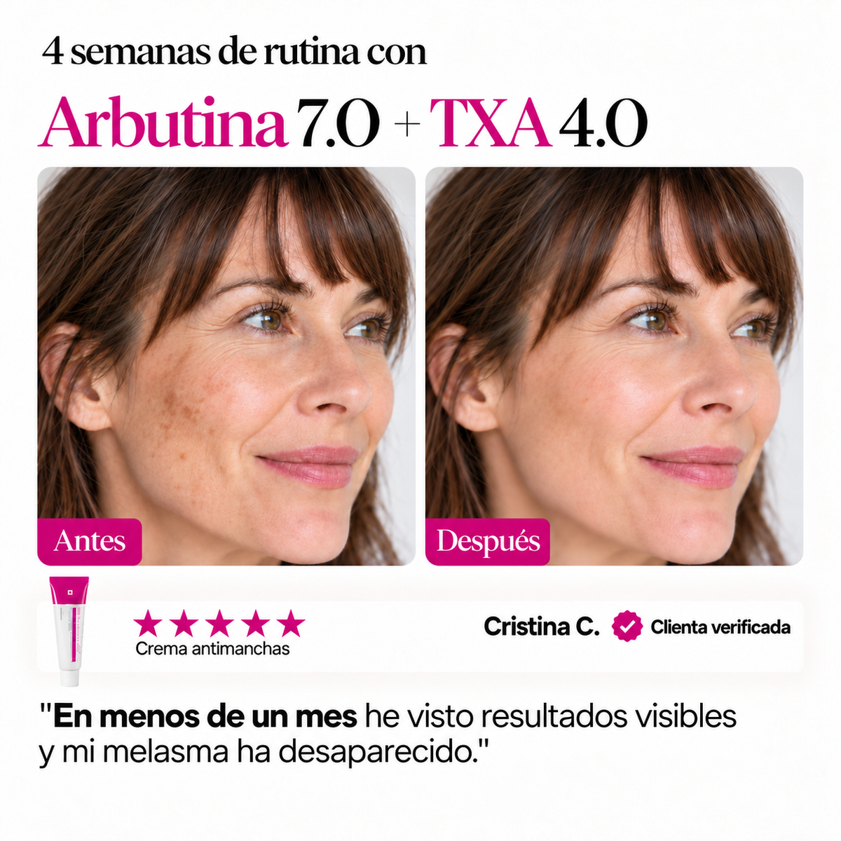 Crema Antimanchas – Auria Vera
